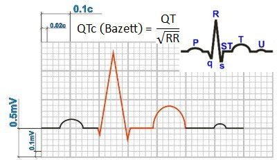 Расчет корригированного QT – Формула Базетта (Bazett’s formula) – QTc